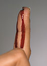 Finger wound
