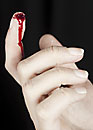 Finger wound